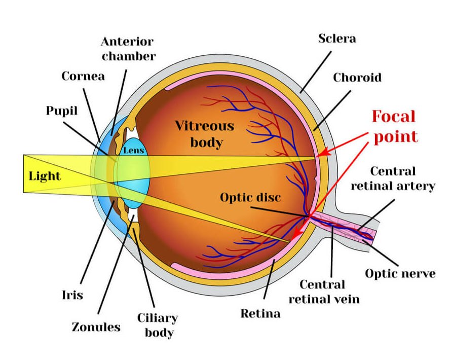 Refractive errors eyeball. Astigmatism.