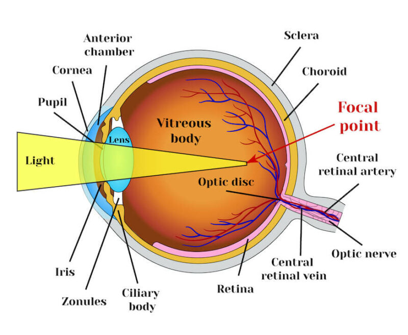 Refractive Surgery - Multack Eye Care