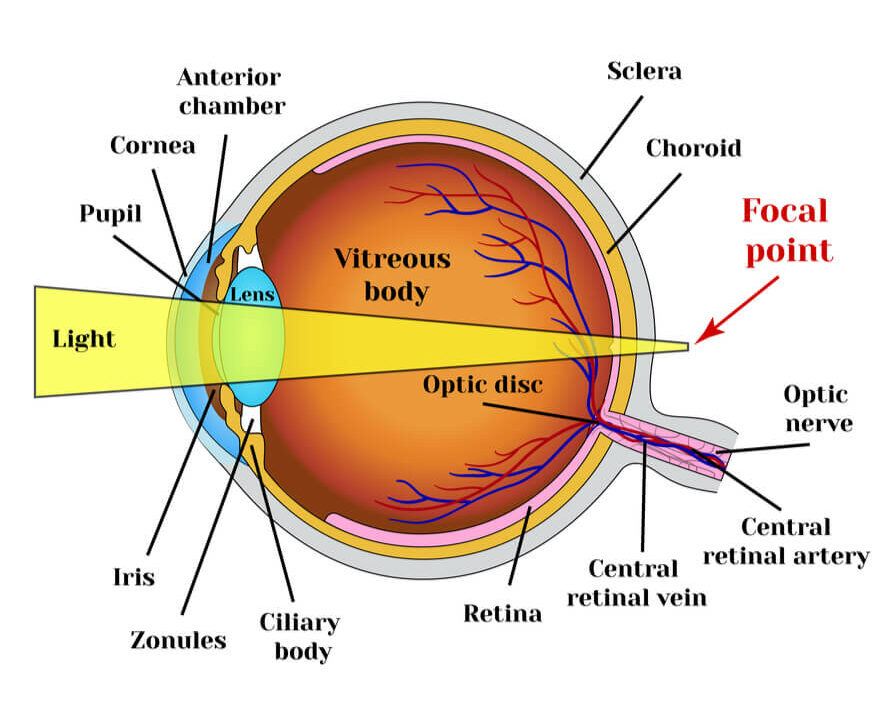 Refractive errors eyeball. Presbyopia. The lens loses its flexibility whith age.
